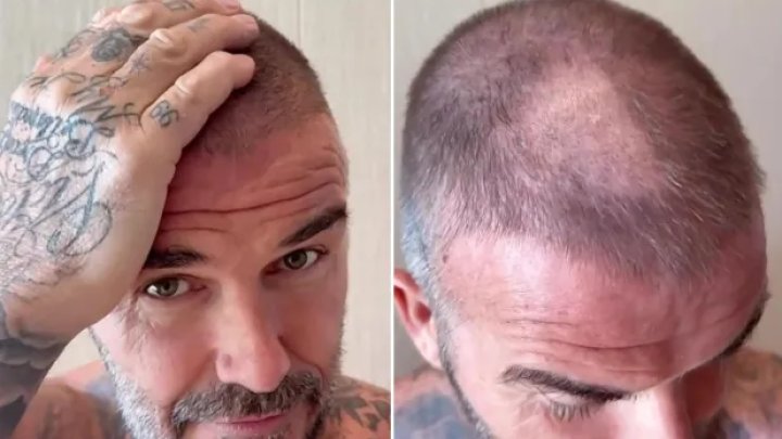 David Beckham 
