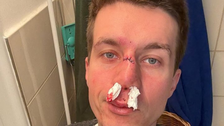 Daniel Krejčík si ublížil. 